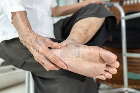 Mujer anciana que se masajea el pie, fascitis plantar, dolor en las plantas del pie y el talón, síndrome del túnel tarsal, compresión de un nervio en el pie o tendinitis de Aquiles, inflamación del tendón en la parte posterior del talón