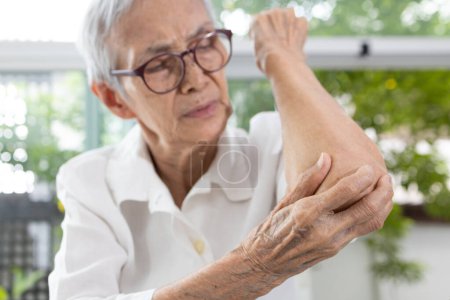 Photo for Old Elderly experiencing elbow pain,stiffness and swelling,irritation of joint,painful inflammation of tendons in the elbow,diseases of Rheumatoid Arthritis,Osteoarthritis,Bursitis,health care concept - Royalty Free Image