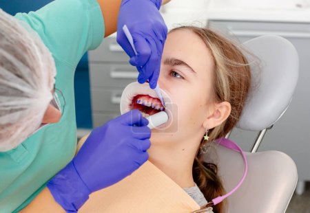 Concept of dental care. The process of installing orthodontic ceramic brackets. Close-up view of dentist's hands applying blue glue to patient's clean bottom teeth before attaching braces