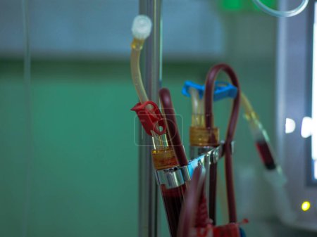 Téléchargez les photos : Tuyaux et tubes remplis de sang qui sortent des veines du patient pour s'écouler vers la machine de dialyse - en image libre de droit