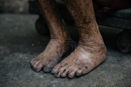 Photo for Close up of male wrinkled legs - Royalty Free Image