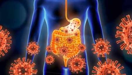Gastroenteritis or stomach flu 3d rendering illustration with red virus cells and human body. Viral, infectious and inflammatory gastric or gastrointestinal tract disease, medical and healthcare concepts.