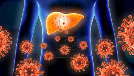 Foto de Hepatitis 3d representación ilustración con glóbulos rojos y el cuerpo humano. Enfermedades hepáticas o hepáticas virales, infecciosas e inflamatorias, conceptos médicos y sanitarios. - Imagen libre de derechos