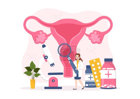 Illustration for Endometriosis with Condition the Endometrium Grows Outside the Uterine Wall in Women for Treatment in Flat Cartoon Hand Drawn Templates Illustration - Royalty Free Image