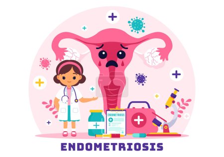 Illustration for Endometriosis Vector Illustration with Condition the Endometrium Grows Outside the Uterine Wall in Women for Treatment in Flat Cartoon Background - Royalty Free Image