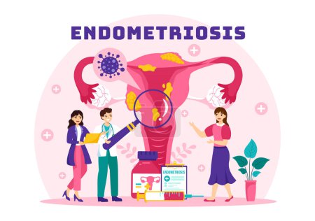 Illustration vectorielle de l'endométriose avec condition l'endomètre grandit en dehors de la paroi utérine chez les femmes pour le traitement en fond plat de bande dessinée
