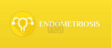 Ilustración de Endometriosis Banner médico amarillo Ilustración - Imagen libre de derechos