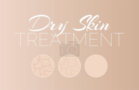 Illustration for Dry Skin Treatment Background Illustration - Royalty Free Image