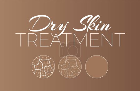 Illustration for Dry Skin Treatment Background Illustration with Skin Texture Close up - Royalty Free Image