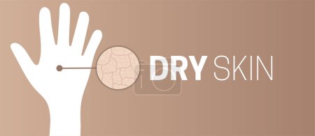 Illustration for Dry Skin on Hand Nude Background Illustration Design - Royalty Free Image