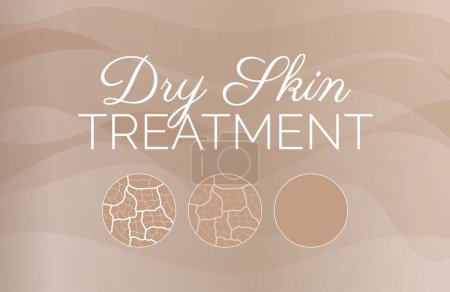 Illustration for Modern Dry Skin Treatment Background Illustration Design - Royalty Free Image