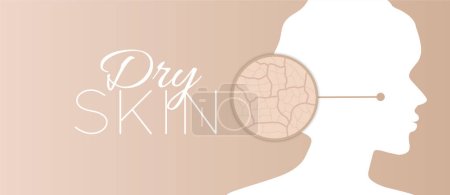 Illustration for Dry Face Skin Background Illustration Design - Royalty Free Image
