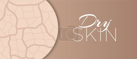 Illustration for Dry Skin Background Illustration Design - Royalty Free Image