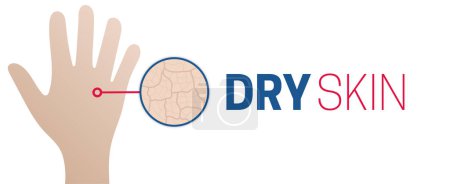 Illustration for Dry Skin Medical Style Background Illustration Design - Royalty Free Image
