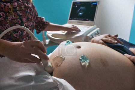 Foto de Primer plano del vientre grande de una mujer embarazada acostada en una cama de hospital que recibe una ecografía del embarazo con un instrumento ultrasónico por un médico durante un chequeo rutinario - Imagen libre de derechos