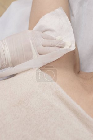 Photo for Girl in a beauty salon. Preparing for the laser hair removal procedure. Armpit depilation. The beautician treats the client's hand with a napkin. The concept of body care, hygiene. - Royalty Free Image