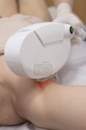 Photo for Girl in a beauty salon. Procedure of laser hair removal of hands or removal of age spots. Cosmetologist works with a laser device. The concept of body care, hardware cosmetology. - Royalty Free Image