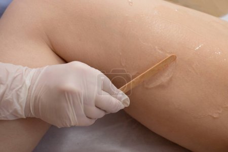 Photo for Girl in a beauty salon. Preparing for the procedure of laser hair removal of the legs. Beautician applies the gel to the inside of the thigh. Concept of body care, hygiene, skin, hardware cosmetology. - Royalty Free Image