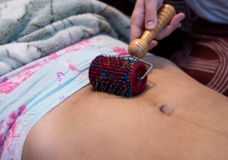 Photo for Postpartum doula shows how to massage a cesarean scar with a Lyapko applicator. Recovery procedures after childbirth. - Royalty Free Image