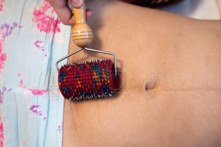 Foto de La doula posparto muestra cómo masajear una cicatriz de cesárea con un aplicador Lyapko. Procedimientos de recuperación después del parto. - Imagen libre de derechos