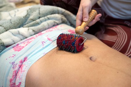 Foto de La doula posparto muestra cómo masajear una cicatriz de cesárea con un aplicador Lyapko. Procedimientos de recuperación después del parto. - Imagen libre de derechos