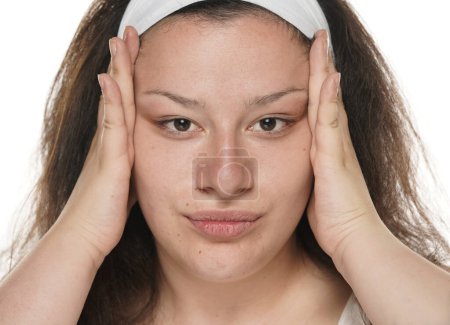 Téléchargez les photos : Jeune femme joufflue serrant sa peau de visage avec ses paumes sur un fond de studio blanc. - en image libre de droit