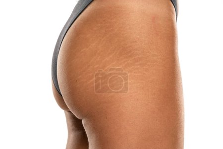 Photo for Female tanned hips with a stretch marks and cellulite on white studio background. - Royalty Free Image