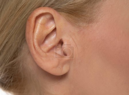 Photo for Hearing, body part and middle age concept - close up of senior woman ear - Royalty Free Image