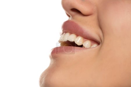 Photo for Laughing woman mouth with great healthy white teeth - Royalty Free Image