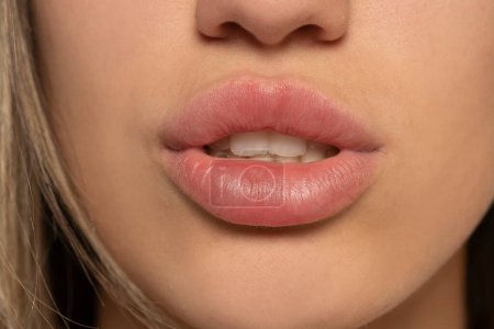 Foto de Parte de la cara, joven mujer de cerca disparó. Sexy rellenar los labios sin maquillaje - Imagen libre de derechos