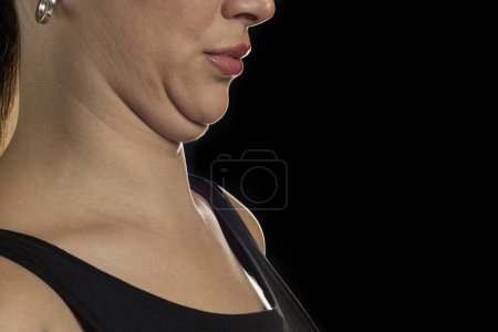 Téléchargez les photos : Jeune femme avec double menton sur fond studio noir, gros plan. Espace pour le texte - en image libre de droit
