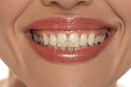 Foto de Primer plano de la boca de una mujer, capturando una sonrisa segura y perfectos dientes y labios naturales - Imagen libre de derechos