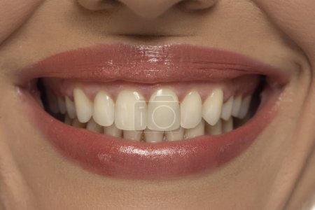 Foto de Primer plano de la boca de una mujer, capturando una sonrisa segura y perfectos dientes y labios naturales. - Imagen libre de derechos