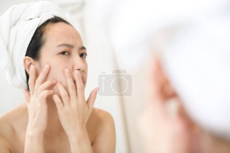 Photo for Problem skin. Concerned young asian women popping pimple on cheek while standing near mirror in bathroom. Unhappy girl inspecting face, suffering acne, focus on reflection - Royalty Free Image