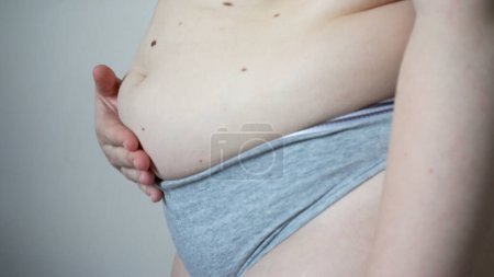 Photo for Young overweight or plus size woman with fat big belly, surgery and fat splitting concept, xl size people life, fat and fat concept - Royalty Free Image