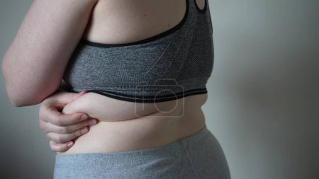 Photo for Close-up of fat folds on the large belly of an overweight woman. Concept of overweight, female obesity, dieting and overweight problems - Royalty Free Image