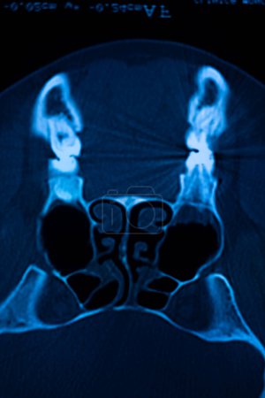 Téléchargez les photos : Radiographie crâne nez résultats des examens médicaux de la clinique de l'hôpital. - en image libre de droit