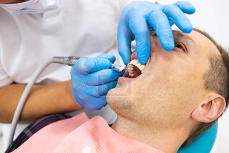 Foto de Primer plano del uso de taladros dentales para dientes de pacientes en el consultorio dental en un procedimiento de tratamiento dental - Imagen libre de derechos