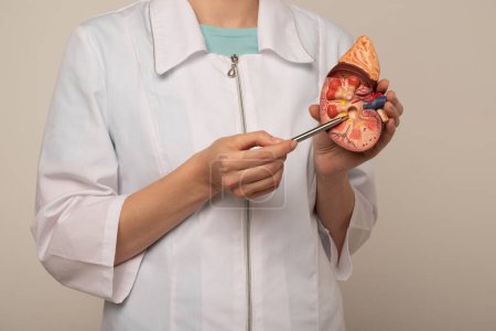Nephrologe zeigt auf anatomisches Nierenmodell in der Hand.