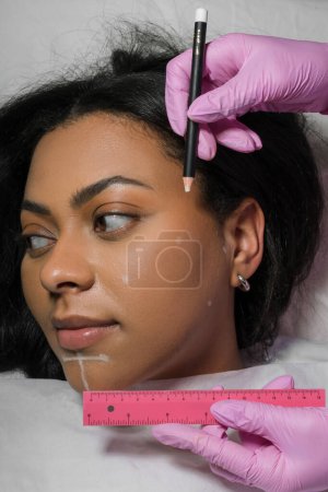 Photo for Making beauty, modifying face to make non-surgical or surgical correction, plastic surgery. correction of asymmetry. Young woman, female patient. Concept of lifting. High quality photo - Royalty Free Image