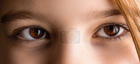 Strabismus. Close-up part childs face, eyes girl. Little patient strabismus, treatment ophthalmic diseases. Strabismus in children causes, treatment concept. Female eyes with strabismus. Hypertropia.