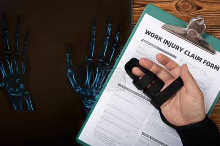 Photo for X-ray film and a man with wrapped hand on a work injury claim form - Royalty Free Image