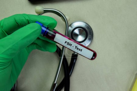 Téléchargez les photos : Concept de FSH - Test avec échantillon de sang. Soins de santé ou concept médical - en image libre de droit