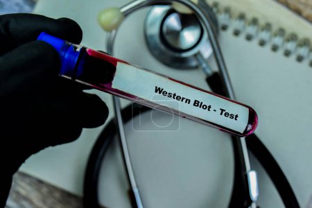 Foto de Concepto de Western Blot - Prueba con muestra de sangre. Salud o concepto médico - Imagen libre de derechos