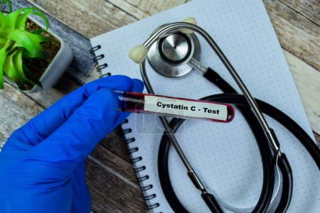 Téléchargez les photos : Concept de Cystatin C - Test avec échantillon de sang. Soins de santé ou concept médical - en image libre de droit