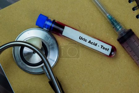 Concept of Uric Acid - Test with blood sample. Healthcare or medical concept