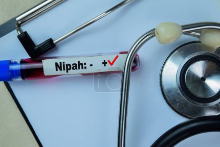 Nipah - Test mit Blutprobe. Draufsicht isoliert auf dem Schreibtisch. Gesundheitswesen oder medizinisches Konzept