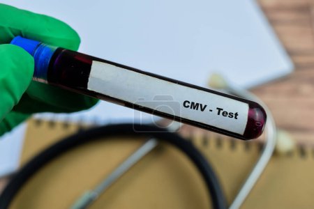 CMV - Test mit Blutprobe auf Holzgrund. Gesundheitswesen oder medizinisches Konzept