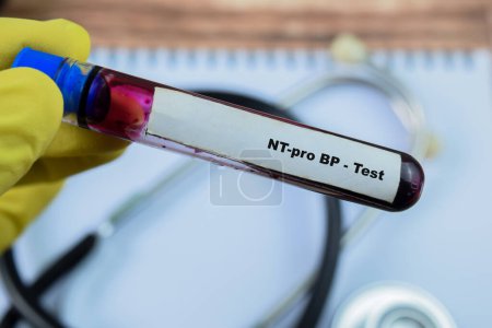 NT-pro BP - Prueba con muestra de sangre sobre fondo de madera. Salud o concepto médico