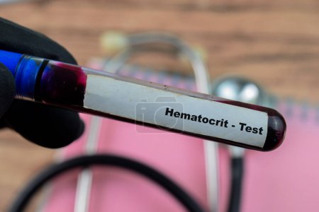 Hematocrit - Test with blood sample on wooden background. Healthcare or medical concept